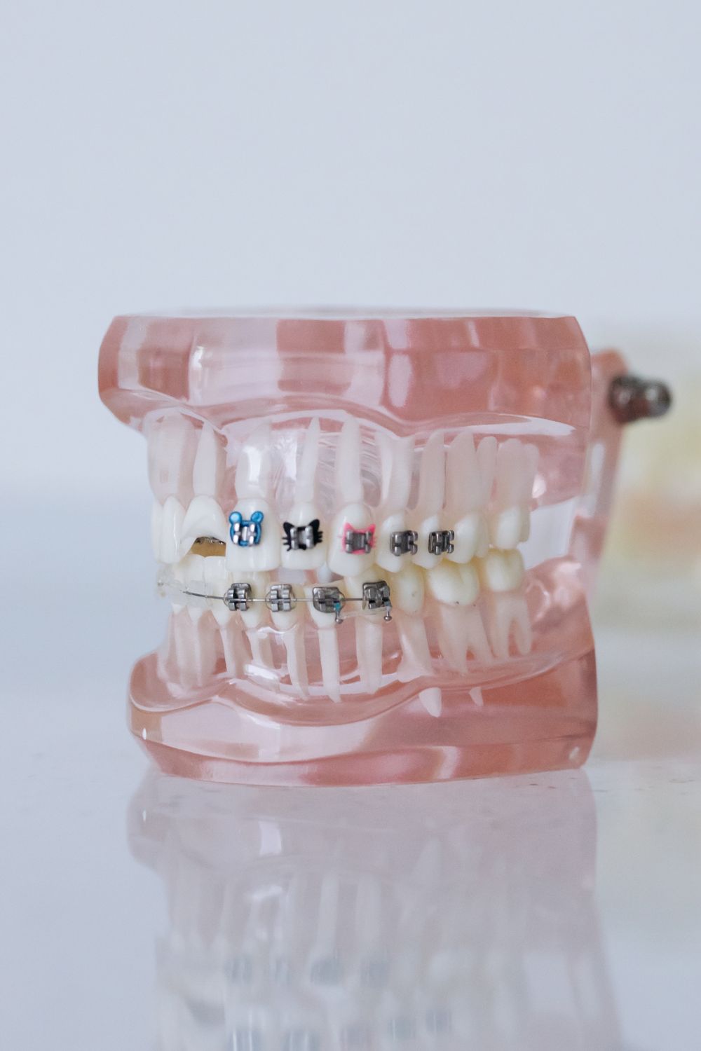 ¿Cuánto cuestan los brackets en CDMX?