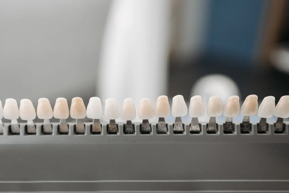 Porcelain vs. resin veneers: which to choose?