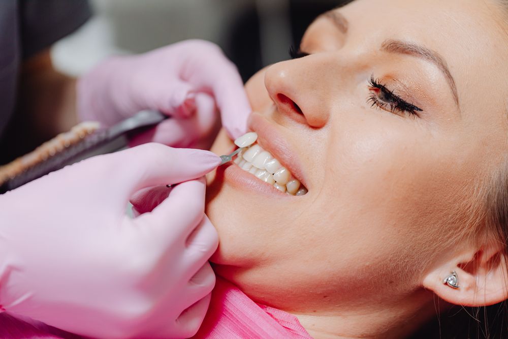 ¿Cuánto cuestan las carillas dentales en CDMX?