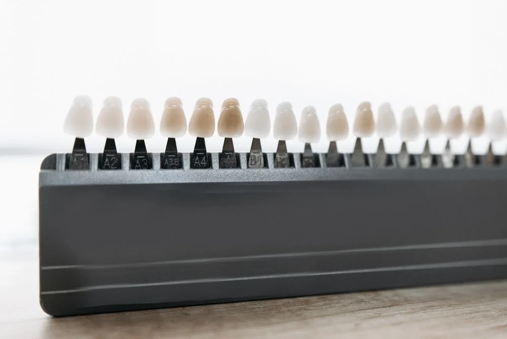 How to care for your dental veneers