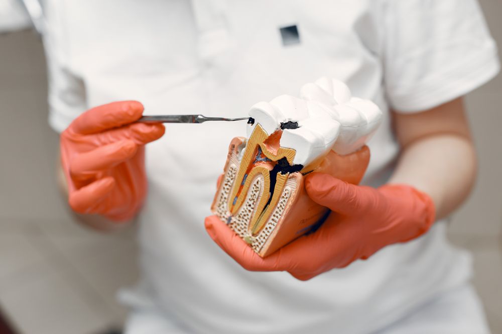 Modelo dental para explicar la endodoncia