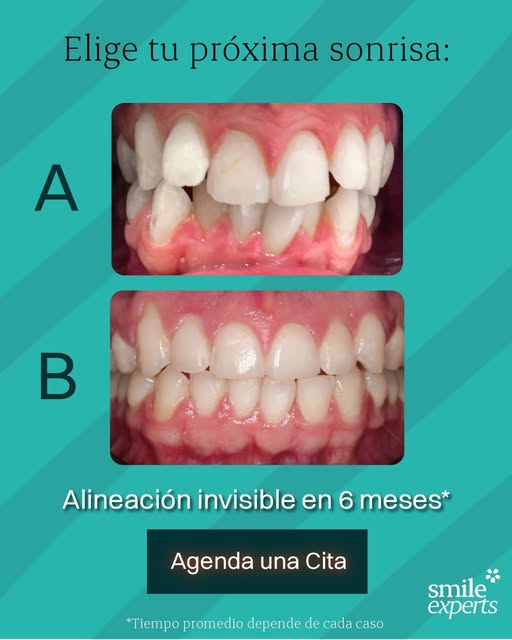 Antes y después · Instagram
