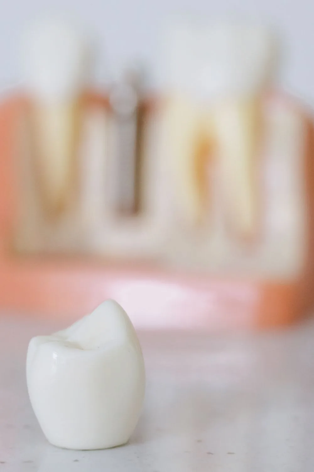 Implant vs. bridge vs. removable denture: what to choose?