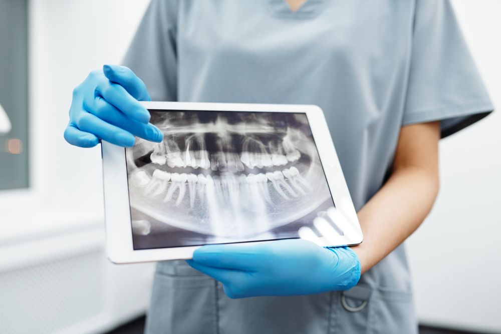 Diagnóstico por imagen para cirugía oral