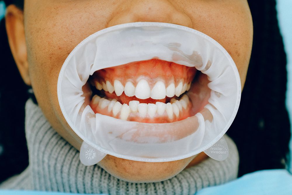 Periodoncia