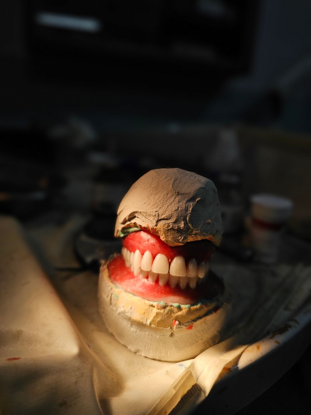 ¿Qué son las prótesis dentales removibles?