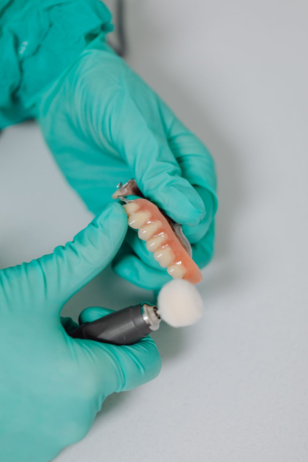 ¿Cuánto cuesta una prótesis dental removible en CDMX?