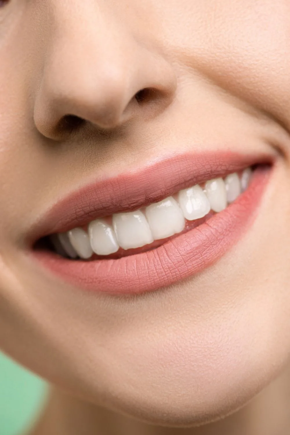 Bright smile after teeth whitening